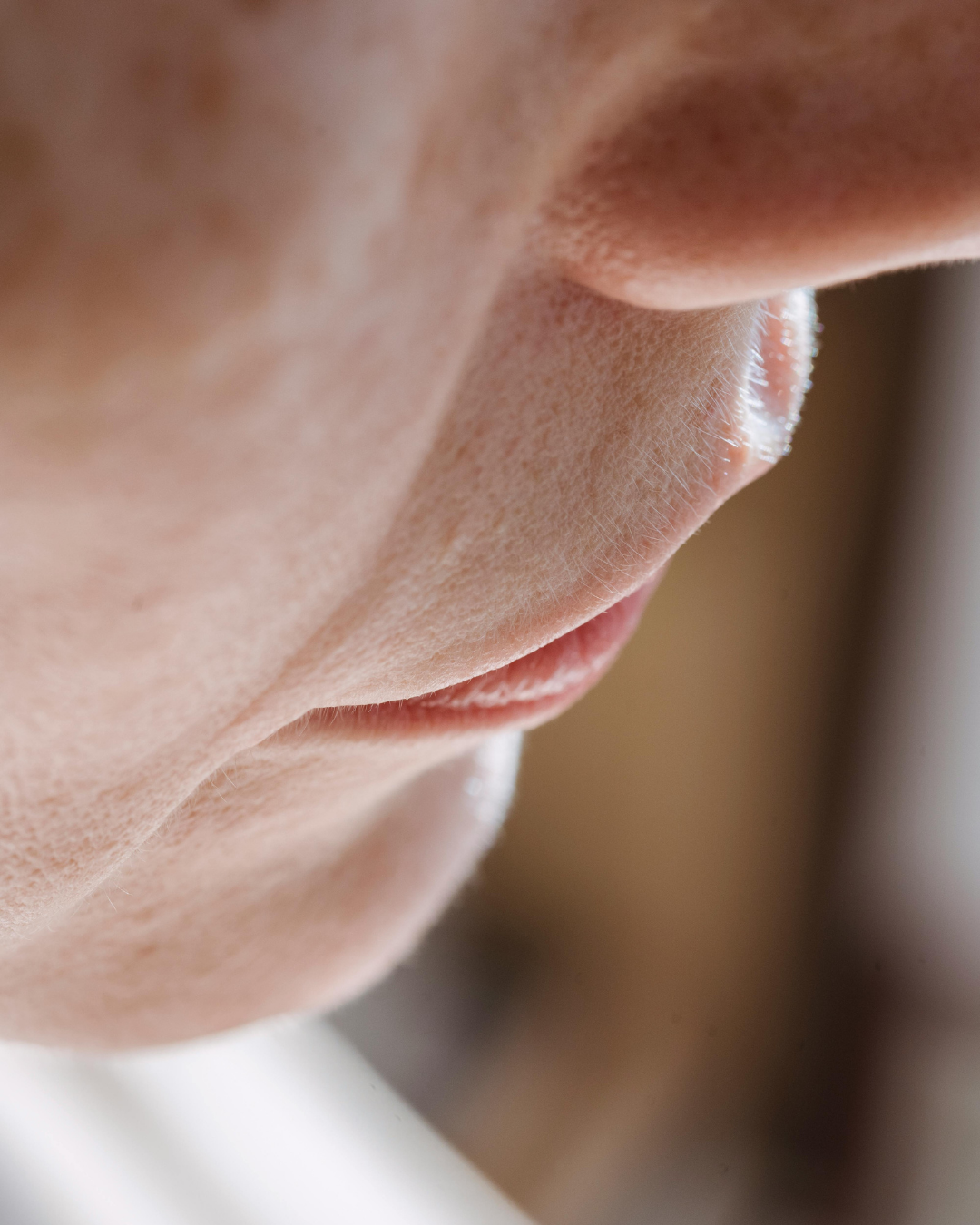 That Rash Around Your Mouth Might Be Perioral Dermatitis